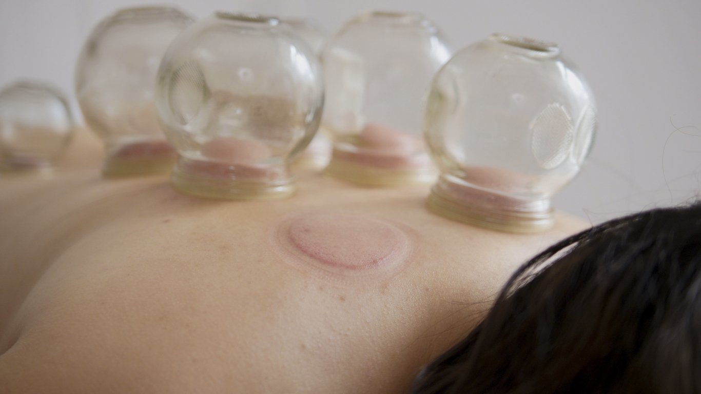 Cupping sexual