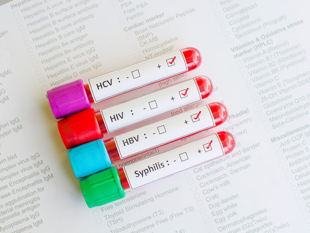 8 Myths About STIs – And the Truth Behind Them