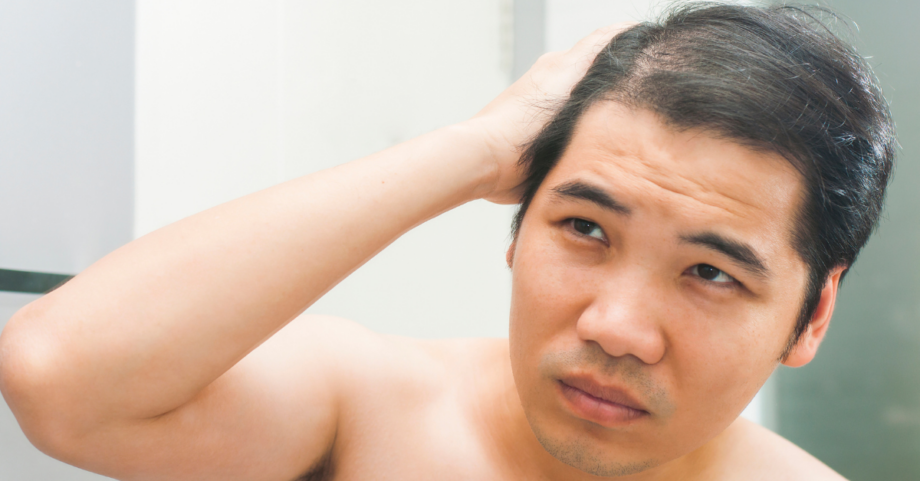 Can Masturbation Cause Hair Loss?